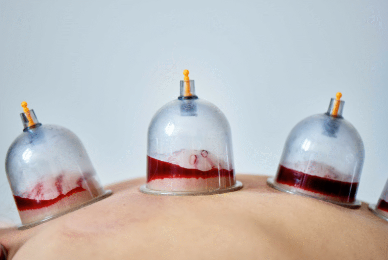 الحجامة المنزلية بالرياض